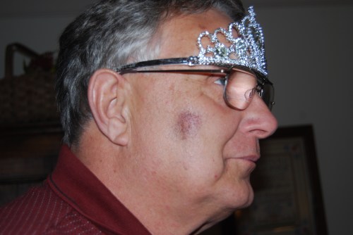 jr in tiara with bruise 6-4-2009 1-20-58